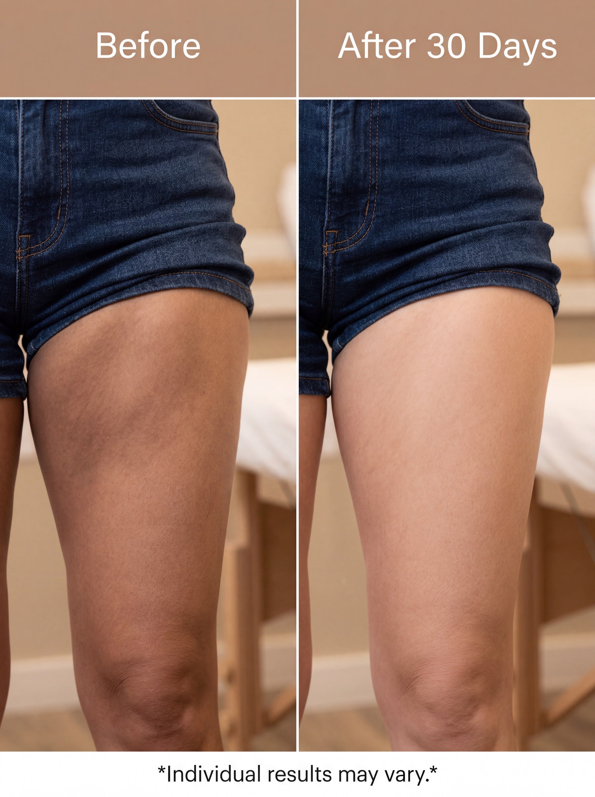 Before and After 30 Days - inner thigh skin tone evening