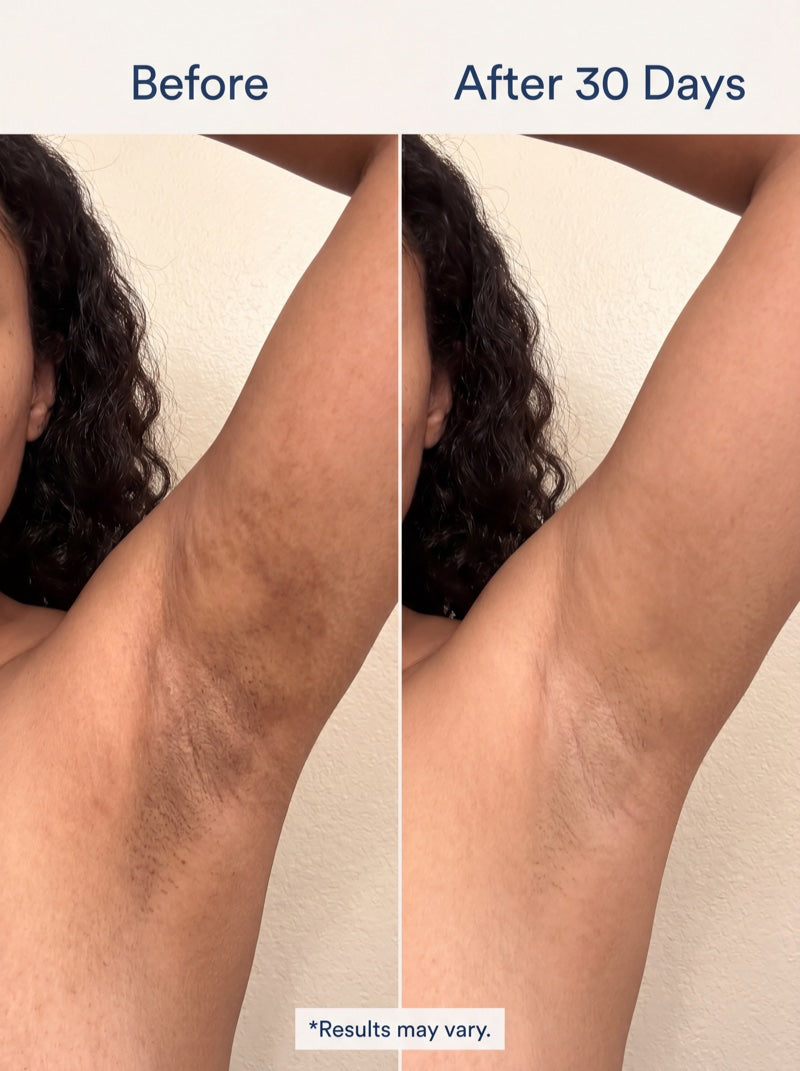 Before - Day 1